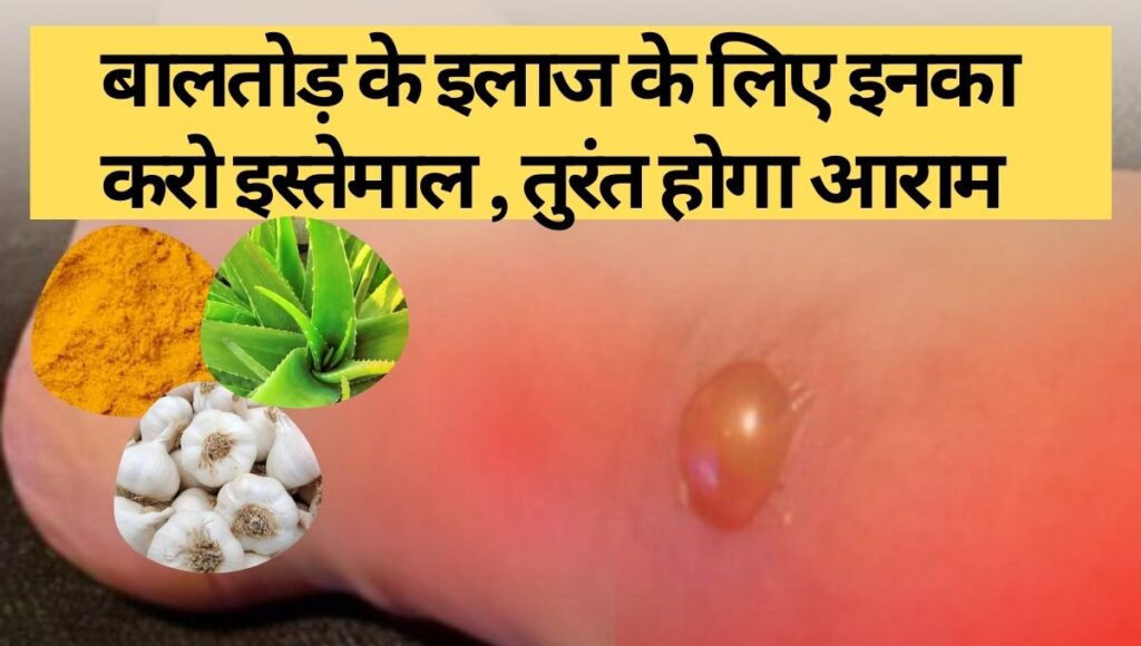 Baltod Kyu Hota Hai